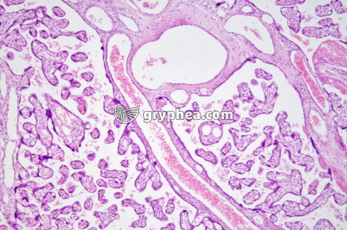 Placenta humain x25 - gryphea.org